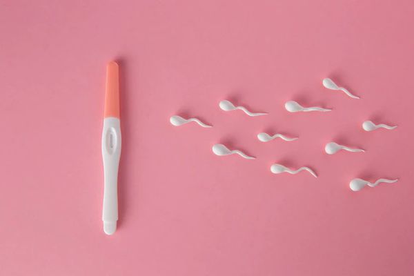 IVF with Sperm Donation
